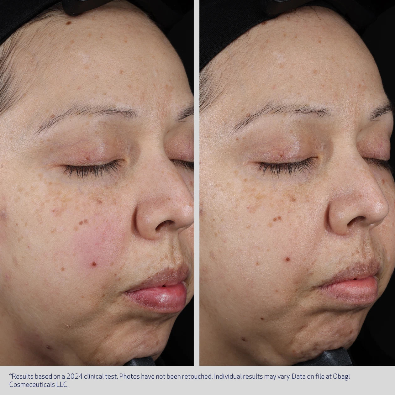 Moisture Restore - Image 5