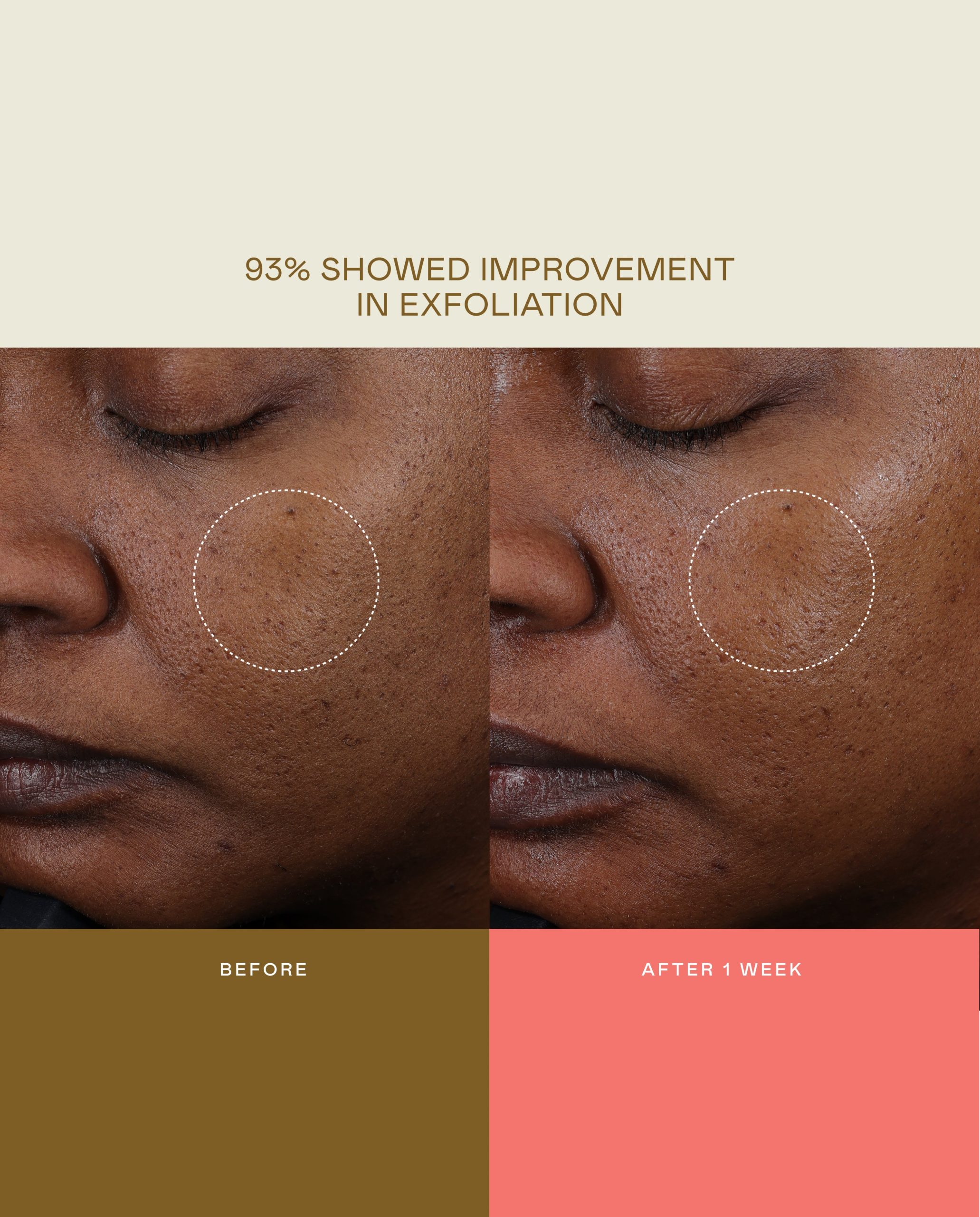 Milky Exfoliating Essence - Image 8