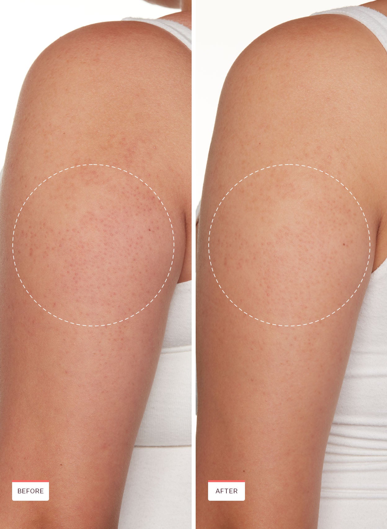 KP Bump Boss Smoothing Body Lotion - Image 3