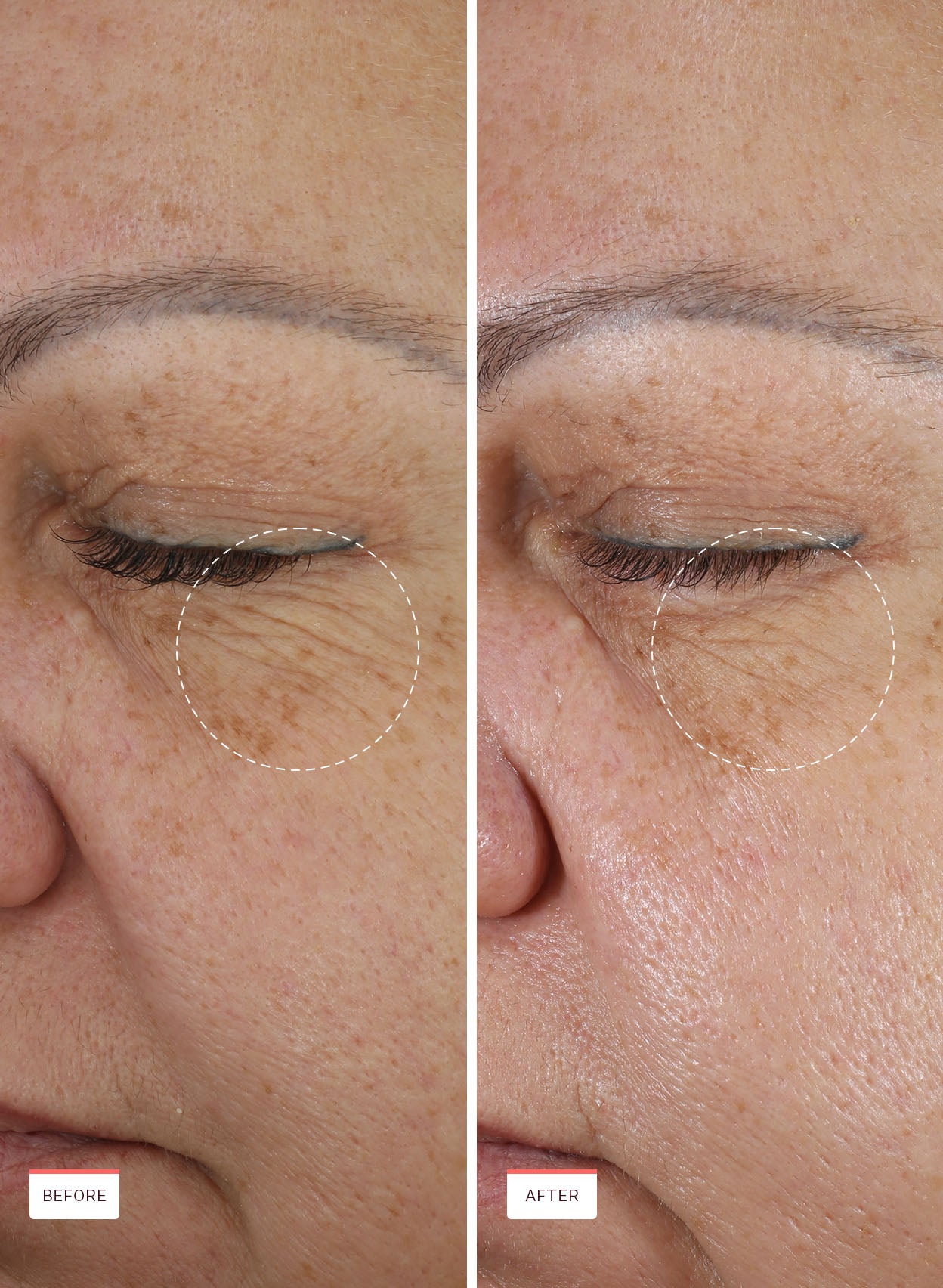 Retinal For All Renewing Serum - Image 4