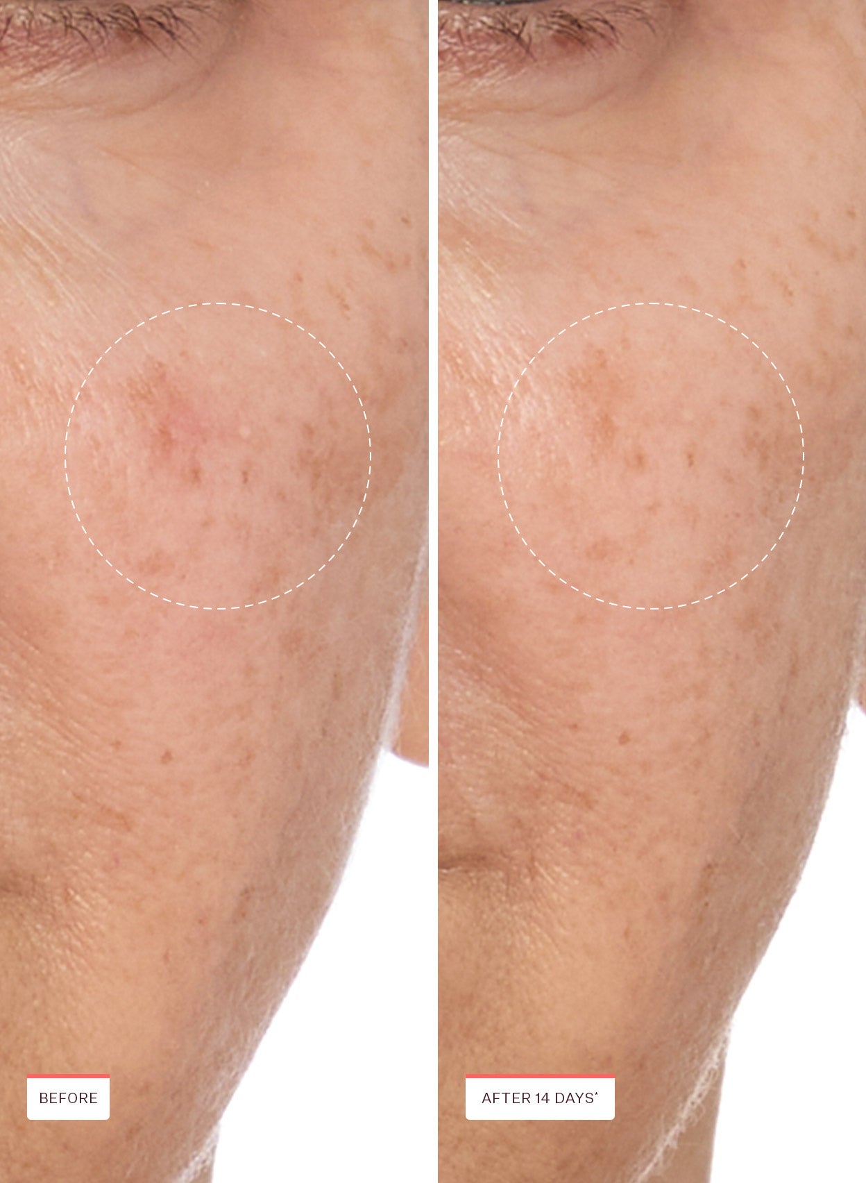 Transparen-C Pro Brightening Moisturizer - Image 4