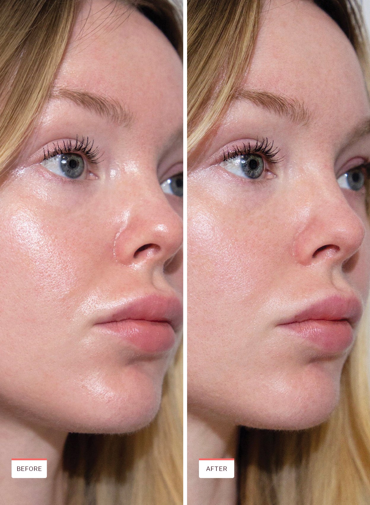 Oil Control Pore Serum - Image 7