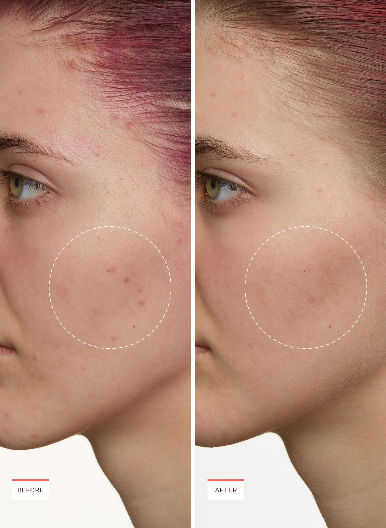 Super Fade Discoloration Moisturizer - Image 7